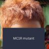 CCMB scientists identify rare gene behind Indian girl’s red hair