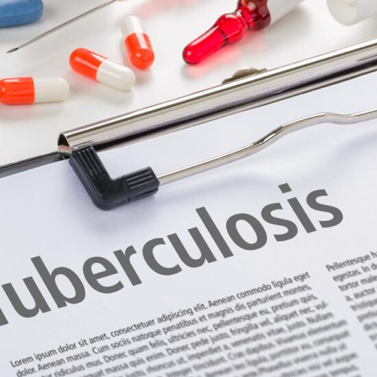 India needs innovative strategies to eliminate TB